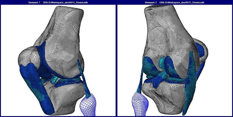 [تصویر:  Human_knee_joint_FE_model.jpg]