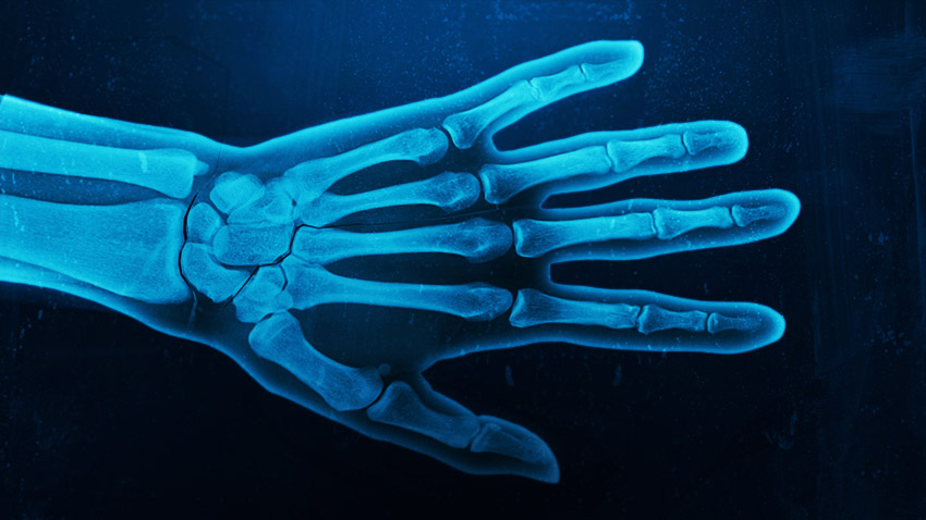 طراحی یک جلوه تصویر اشعه ایکس با فتوشاپ