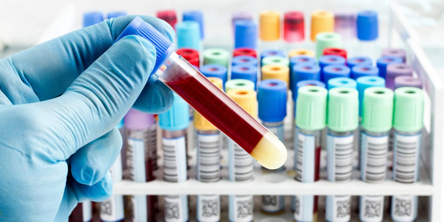 آزمایش خون | روش خواندن، انواع و علائم اختصاری