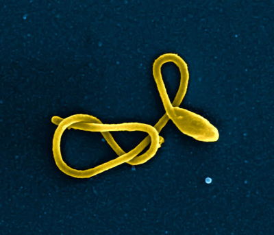 ویروس ابولا