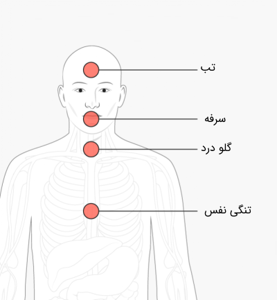 علائم بیماری ویروس کرونای جدید ۲۰۱۹
