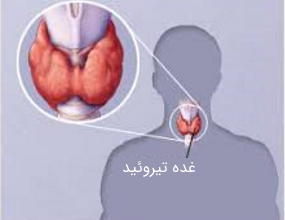 غده تیروئید