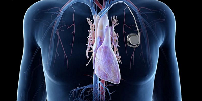دستگاه قابل کاشت ضبط کننده لوپ قلب