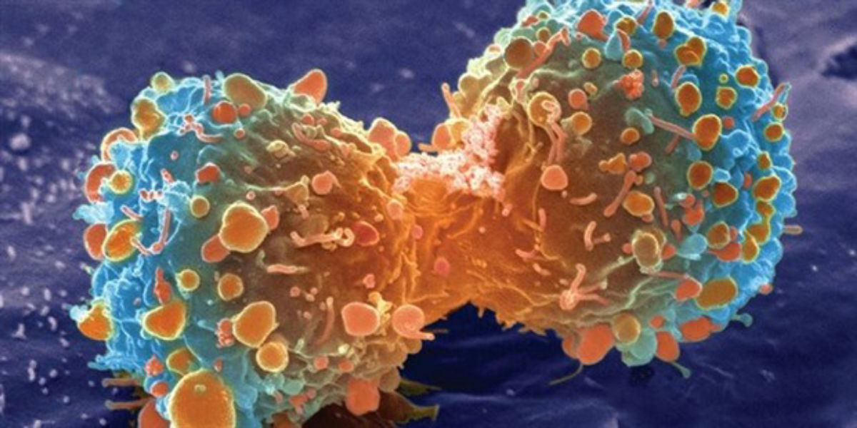 آنچه در مورد سرطان باید بدانید