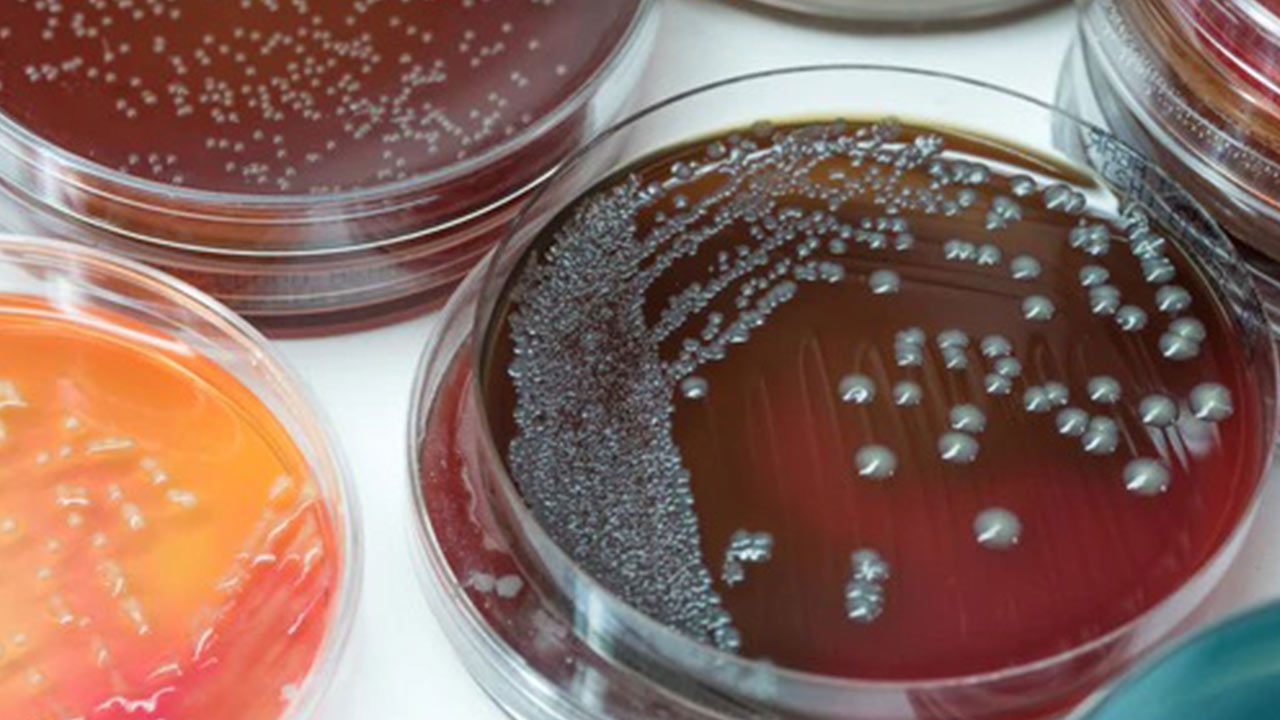 کشت باکتری | محیط کشت و انواع روش ها — از صفر تا صد