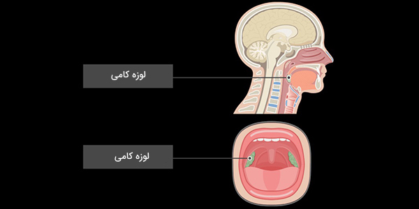 لوزه کامی