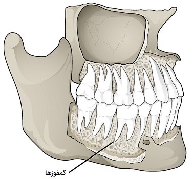 مفاصل دندان