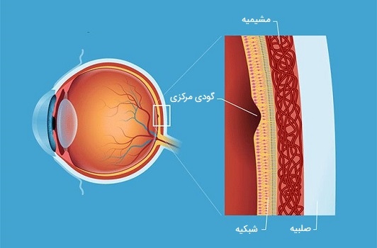 گودی مرکزی چشم انسان