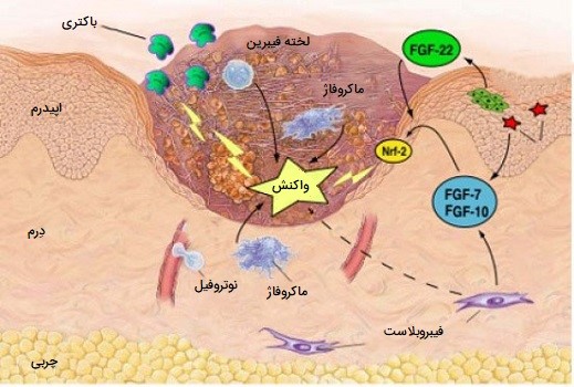 ترمیم زخم