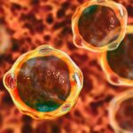 بلاستوسیستیس هومینیس چیست و چگونه درمان می شود؟ – به زبان ساده