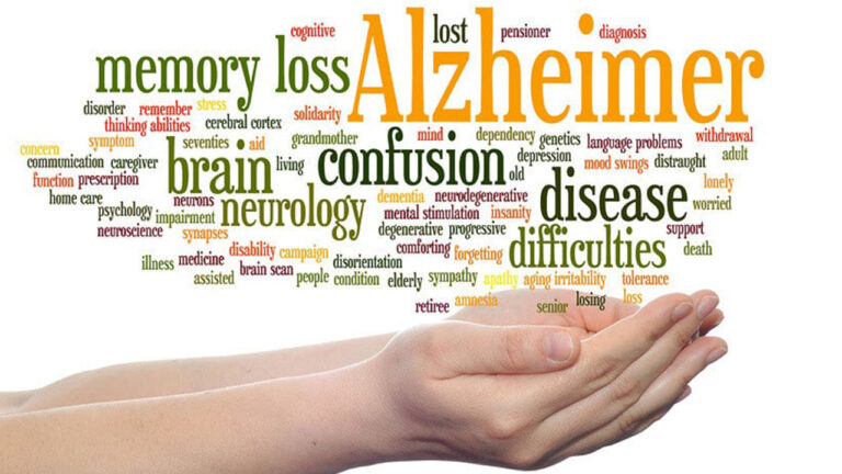 آلزایمر چیست؟ — علت، پیشگیری، تشخیص، داروها و درمان به زبان ساده