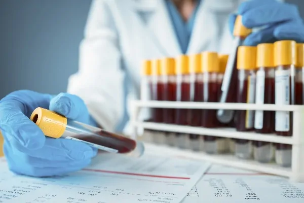 آزمایش خون