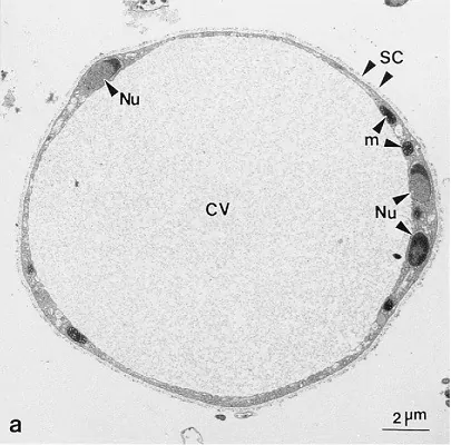 فرم واکوئولار بلاستوسیستیس
