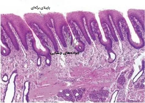 پاپیلای برگه ای