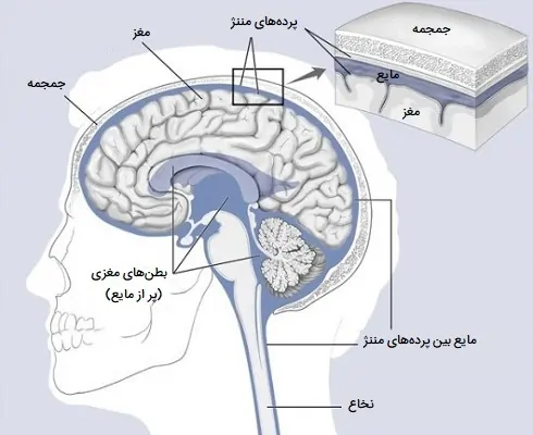 پرده مغز و بطن مغزی