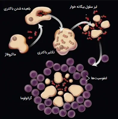 گرانولوماتوز و مردن بیگانه خوار ها