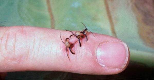 مورچه های بخیه زننده