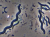 شکل اسپیریلیوم پروکاریوت زیر میکروسکوپ