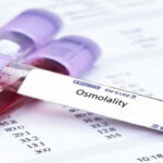 اسمولالیته چیست؟ – به زبان ساده