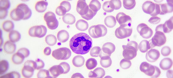رنگ آمیزی سلول خونی 