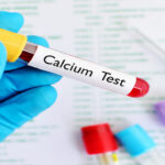 تنظیم کلسیم خون – به زبان ساده + هورمون و غده