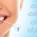 قیمت ایمپلنت دندان در تهران