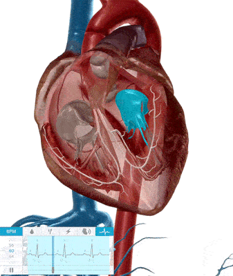 دریچه های قلب در الکتروکاردیوگرام 