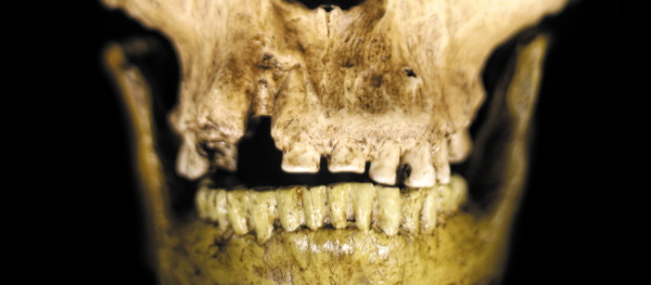 آنالیز ایزوتوپی دندان