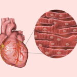 ماهیچه قلبی چیست؟ – به زبان ساده + تعریف و فیزیولوژی