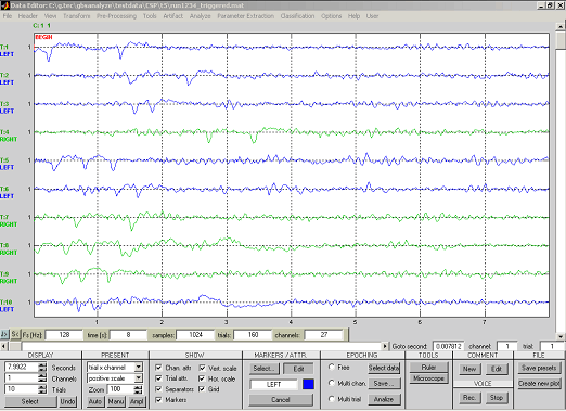 نمایش داده ها در پردازش سیگنال مغزی EEG در متلب