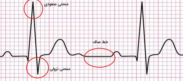 الکتروکاردیوگرام
