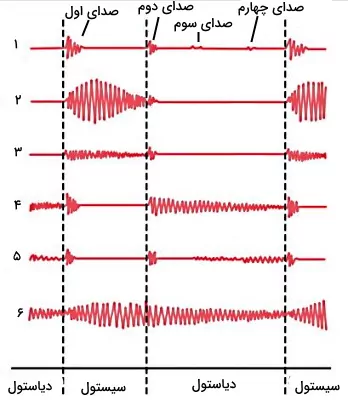فونوکاردیوگرام