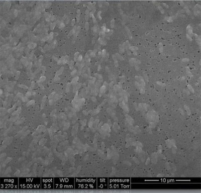 تصویر میکروسکوپ الکترونی روبشی از باکتری