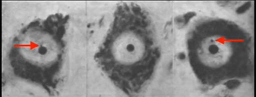 تصویر میکروسکوپی هسته و جسم بار در سلول
