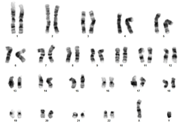 شکل کروموزوم ها در کاریوتایپ سلول های سوماتیک مردان 