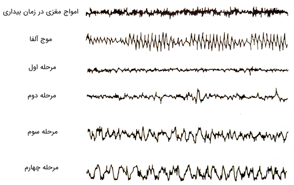 امواج مغزی - امواج مغز در خواب - روانشناسی خواب - روانشناسی فیزیولوژیک