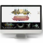 ایمپلنت دیجیتال در تهران + قیمت