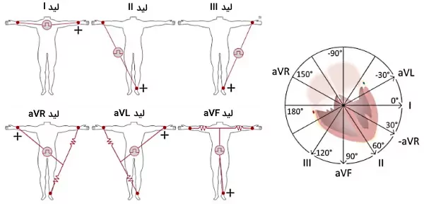 لیدهای ekg