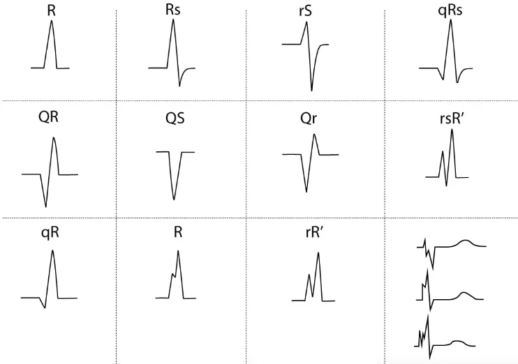 انواع کمپلکس qrs در نوار قلب