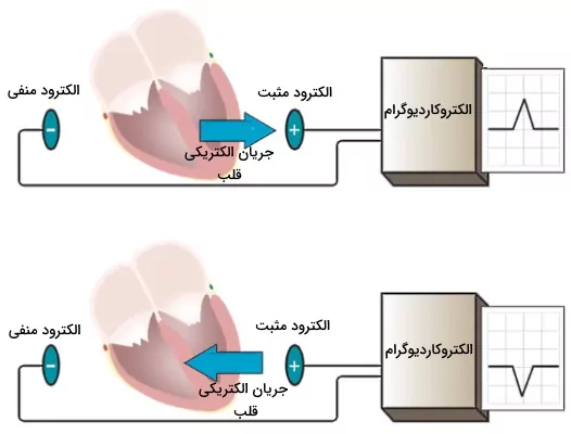 لیدهای ecg