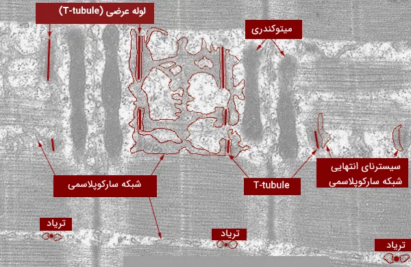 تصویر میکروسکوپ الکترونی از ماهیچه ی اسکلتی- میتوکندری و شبکه سارکوپلاسمی مشخص است