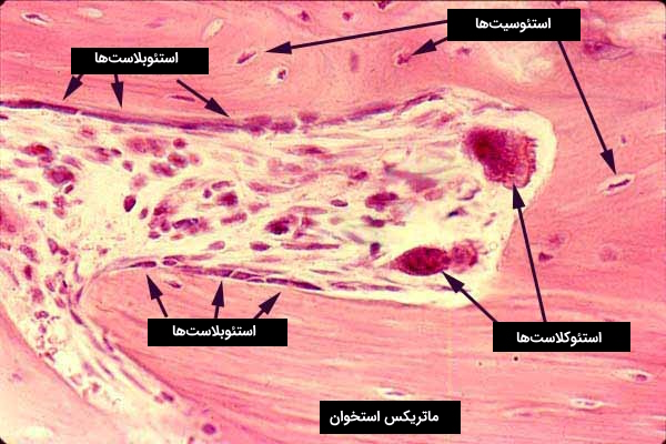 تصویر میکروسکوپی از سلول های استخوانی و ماتریکس استخوان