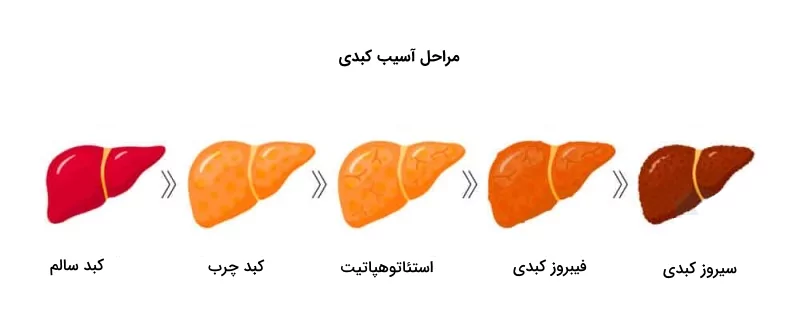 مراحل پیشرفت آسیب‌ های کبدی