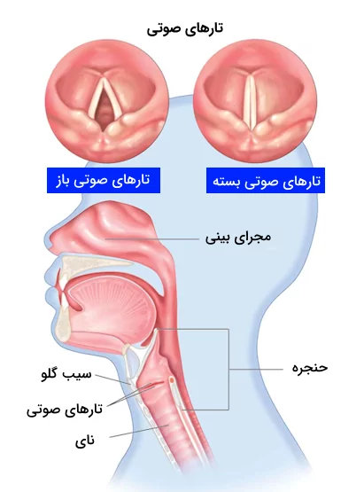 ساختار تارهای صوتی