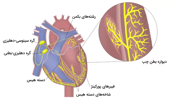 رشته بکمن در شبکه هادی قلب