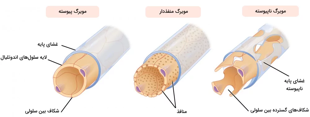 تصویری از ساختار و تفاوت های انواع مویرگ های موجود در بدن