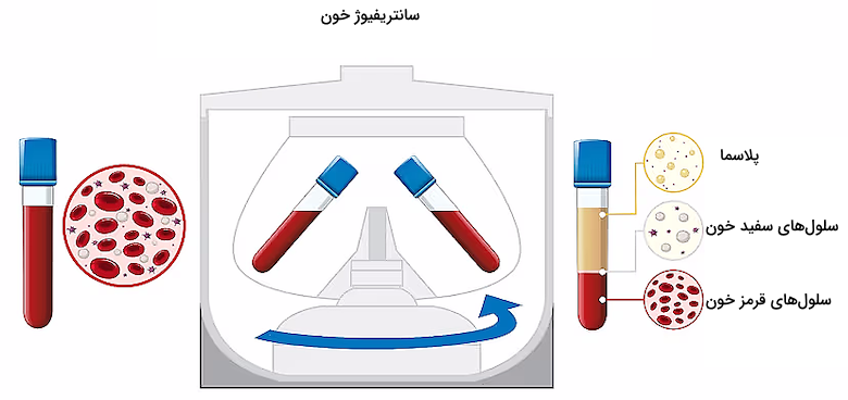 دستگاه سانتریفیوژ شامل لوله حاوی خون - خون جدا شده از پلاسما درون لوله ازمایش