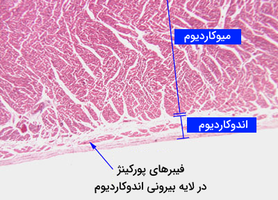 تصویری از بافت قلب زیر میکروسکوپ که لایه های اندوکاردیوم، میوکاردیوم و فیبرهای پورکینژ در آن قابل تشخیص هستند