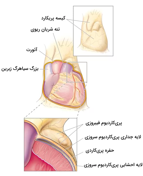 بخش های مختلف پریکاردیوم