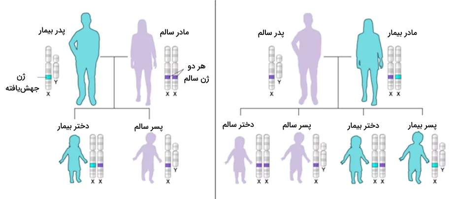 الگوی توارث وابسته به x غالب در دو شرایط مختلف، سمت راست مربوط به زمانی است که مادر بیمار باشد و سمت چپ مربوط به زمانی است که پدر بیمار باشد.